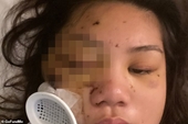 Thiếu nữ gốc Á bị bắn vào mặt ở San Francisco