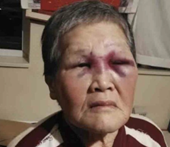 Cụ bà gốc Á bị tấn công ở Mỹ góp 900 000 USD để “chống phân biệt chủng tộc”