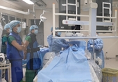 Cảnh báo nguy cơ đột quỵ nếu dùng thuốc tránh thai nhiều năm