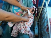 Cuba ghi dấu mốc quan trọng trong phẫu thuật tim ở trẻ sơ sinh