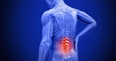 3 bài thuốc đông y chữa đau mỏi lưng