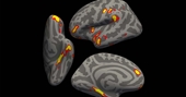 Nghiên cứu mới giải mã bí ẩn sương mù não hậu Covid-19