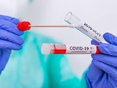Mỗi người có nguy cơ tái nhiễm Covid-19 bao nhiêu lần