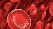 Nhóm máu nào có thể ảnh hưởng đến nguy cơ bị đột quỵ trước 60 tuổi
