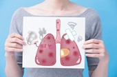 Vì sao nhiều người hút thuốc lâu năm vẫn không bị ung thư phổi