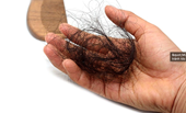 Mùa rụng tóc  Làm thế nào để tránh tóc rụng lả tả, xác xơ