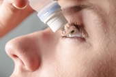 Thuốc kháng viêm nhỏ mắt steroid dùng khi nào, những nguy cơ khi lạm dụng