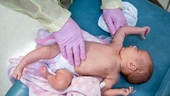 EU phê chuẩn thuốc phòng bệnh đường hô hấp do virus RSV ở trẻ sơ sinh