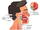 Ai nên thực hiện tầm soát ung thư vòm họng và 4 dấu hiệu quan trọng cảnh báo căn bệnh này