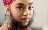 Chân dung cô gái có râu trở thành nhà hoạt động xã hội chống bắt nạt