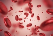 Thiếu máu ác tính Triệu chứng khó nhận biết nhưng để biến chứng thì rất nguy hiểm