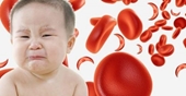 Cách phòng và điều trị thiếu máu, thiếu sắt ở trẻ em