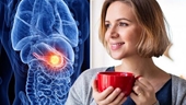 Phát hiện loại trà có thể tiêu diệt các tế bào ung thư