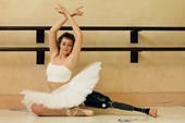 Nghị lực phi thường của vũ công ballet 21 tuổi mắc ung thư với chiếc chân giả