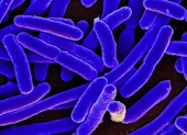 Vi khuẩn E Coli không lành như bạn vẫn nghĩ và 5 chìa khóa phòng ngộ độc thực phẩm