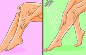 7 bài tập giúp gọn bắp chân cho người bị giãn tĩnh mạch