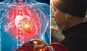 Nghiên cứu mới Tập thể dục buổi sáng có thể làm giảm nguy cơ đau tim và đột quỵ