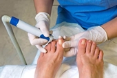 7 bước quan trọng bảo vệ bàn chân ở người bệnh đái tháo đường trong mùa lạnh