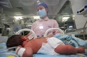 Số liệu báo động về tình trạng trẻ sơ sinh chết non trên toàn cầu