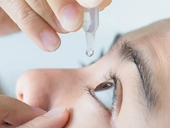 Làm sao để biết khô mắt là do vấn đề hoóc môn