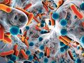 Phát hiện chất mới tiêu diệt được siêu vi khuẩn kháng thuốc