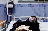 Iran tiến hành điều tra vụ cả ngàn nữ sinh ngộ độc bí ẩn