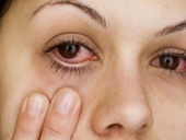 Những triệu chứng bất thường của đôi mắt ai cũng nên biết