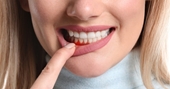Mát xa đường viền nướu ngăn ngừa tụt lợi, loại bỏ cao răng