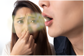 Bác sĩ giải thích lý do hơi thở có mùi ngay cả sau khi đánh răng