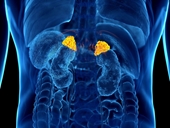 Nhờ một dấu hiệu ở bụng, người phụ nữ phát hiện mắc ung thư