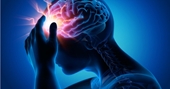 Viêm màng não - viêm não Chẩn đoán và phân biệt