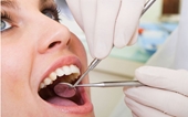 Nhổ răng khôn có thể gặp biến chứng gì