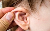 Trẻ dưới 2 tuổi chưa biết kêu đau, đây là cách bố mẹ nhận biết sớm con mắc viêm tai giữa