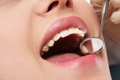 8 mối nguy từ việc bọc răng sứ không đảm bảo chất lượng