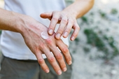 5 nguyên nhân cần chú ý khi bị phát ban do rửa tay