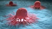 Đột phá từ Mỹ Tìm ra cách khiến tế bào ung thư tự hủy