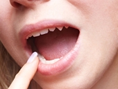 Kiểm tra màu lưỡi để biết về sức khỏe