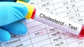 Nghiên cứu mới  Cholesterol tốt không có lợi như người ta tưởng