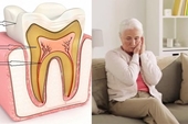 3 vấn đề sức khỏe răng miệng ở người cao tuổi