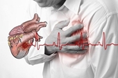 Ai dễ bị nhồi máu cơ tim, cần làm gì để ngăn ngừa