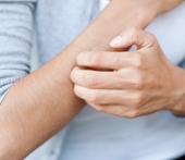 Các nhà khoa học tìm nguyên nhân và “thuốc giải” cho những cơn ngứa ngoài da