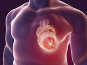 Sau cơn đau tim 4 thay đổi về lối sống giúp giảm nguy cơ tái phát
