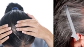 Bí quyết ngăn ngừa rụng tóc ở người cao tuổi