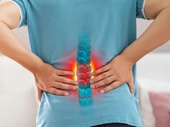 Làm sao để giảm đau cột sống thắt lưng
