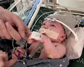 Em bé đầu tiên trên thế giới sống khỏe nhờ ghép một phần trái tim