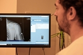Nga mở rộng ứng dụng Trí tuệ nhân tạo trong chẩn đoán hình ảnh X-quang