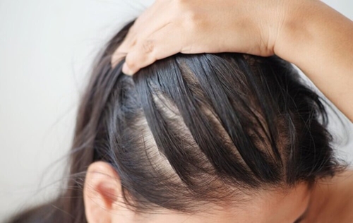 Phương pháp giúp tóc giảm tiết dầu, hạn chế bết dính