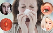Tại sao viêm mũi xoang lại có thể gây mù mắt