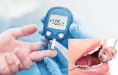 Cách chăm sóc sức khỏe răng miệng ở người bệnh tiểu đường