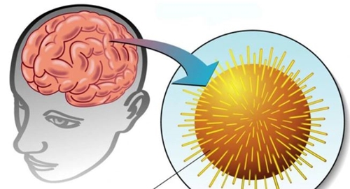 Bệnh viêm não do virus Herpes gây di chứng gì, chữa thế nào
